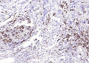 CD38 Recombinant Rabbit Monoclonal Antibody