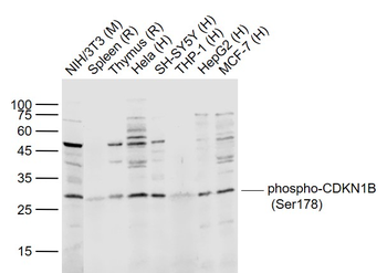 Phospho-CDKN1B (Ser178) Rabbit Polyclonal Antibody