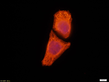 CK18 Mouse Monoclonal Antibody
