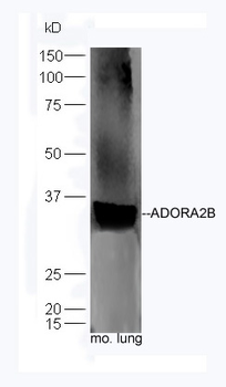 ADORA2B Rabbit Polyclonal Antibody