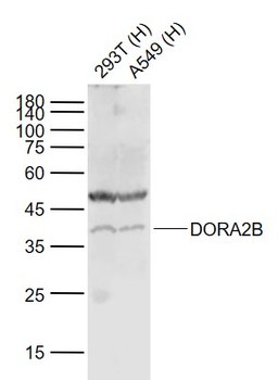 ADORA2B Rabbit Polyclonal Antibody