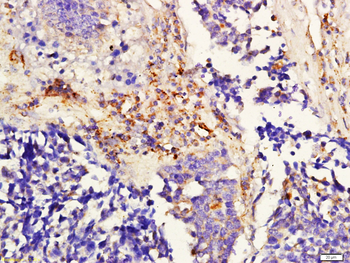 ADORA2B Rabbit Polyclonal Antibody