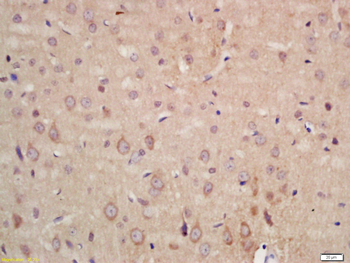 ADORA2B Rabbit Polyclonal Antibody
