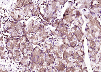 SLC15A1 Rabbit Polyclonal Antibody
