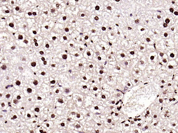 HMGB1 Rabbit Polyclonal Antibody
