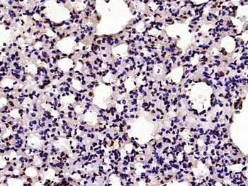 HMGB1 Rabbit Polyclonal Antibody