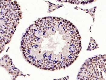 HMGB1 Rabbit Polyclonal Antibody