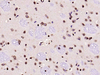 HMGB1 Rabbit Polyclonal Antibody