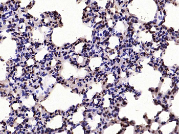HMGB1 Rabbit Polyclonal Antibody