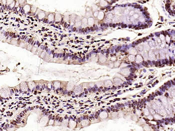 HMGB1 Rabbit Polyclonal Antibody
