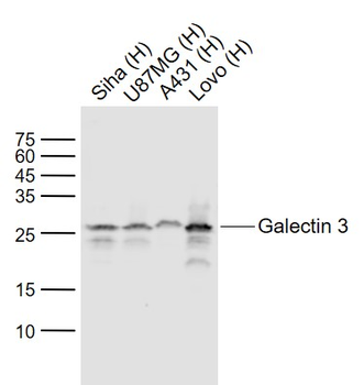 Galectin 3 Mouse Monoclonal Antibody
