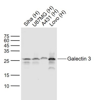 Galectin 3 antibody