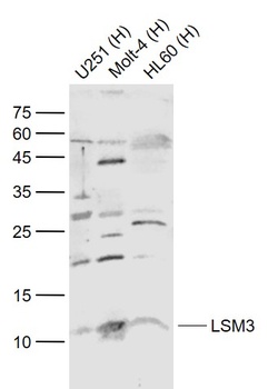 LSM3 antibody