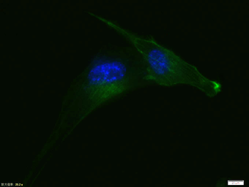 Alpha smooth muscle Actin Recombinant Rabbit Monoclonal Antibody