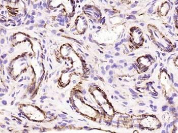 Alpha smooth muscle Actin Recombinant Rabbit Monoclonal Antibody