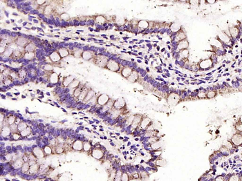 VDAC1 Recombinant Rabbit Monoclonal Antibody (Mitochondrial Loading Control)