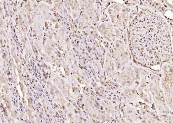 PPM1D Rabbit Polyclonal Antibody