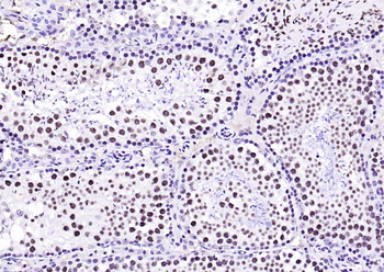 Ubiquitin Mouse Monoclonal Antibody