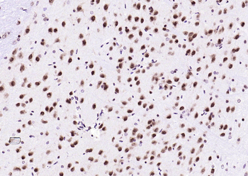 Ubiquitin Mouse Monoclonal Antibody
