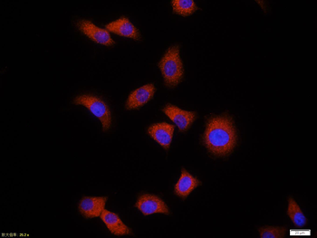Ubiquitin Mouse Monoclonal Antibody