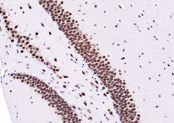 Ubiquitin Mouse Monoclonal Antibody