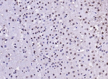 IRS1 (phospho-Tyr1229) antibody