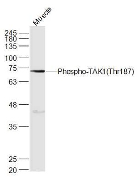TAK1 (phospho-Thr187) antibody