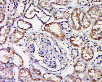 Phospho-TAK1 (Ser192) Rabbit Polyclonal Antibody