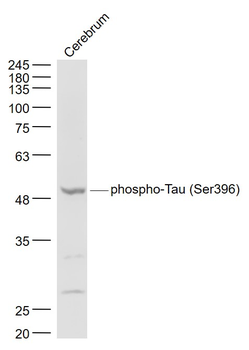 Phospho-Tau (Ser396) Rabbit Polyclonal Antibody
