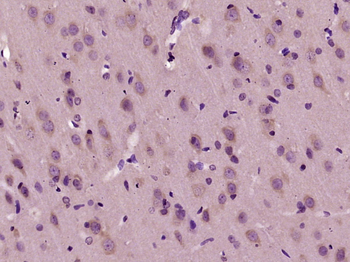 Phospho-Tau (Ser721) Rabbit Polyclonal Antibody