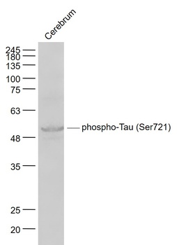 Tau protein (phospho-Ser721) antibody