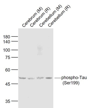 Tau protein (phospho-Ser199) antibody