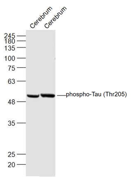 Phospho-Tau (Thr205) Rabbit Polyclonal Antibody