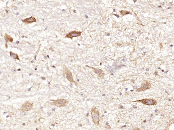 Phospho-Tau (Ser356) Rabbit Polyclonal Antibody