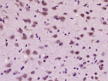 Phospho-Tau (Ser356) Rabbit Polyclonal Antibody