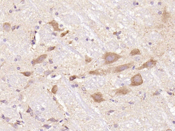 Phospho-Tau (Ser356) Rabbit Polyclonal Antibody