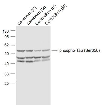 Phospho-Tau (Ser356) Rabbit Polyclonal Antibody