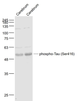 Phospho-Tau (Ser416) Rabbit Polyclonal Antibody