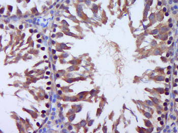 Talin Rabbit Polyclonal Antibody