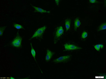 Phospho-TERT (Ser1125) Rabbit Polyclonal Antibody