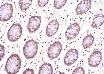 TRIM24 Rabbit Polyclonal Antibody