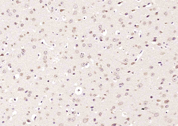 TRIM24 Rabbit Polyclonal Antibody