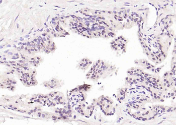 TRIM28 Rabbit Polyclonal Antibody