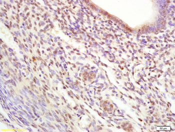 TRIM28 Rabbit Polyclonal Antibody