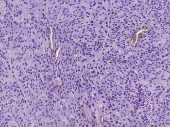 Phospho-p38 MAPK (Tyr323) Rabbit Polyclonal Antibody