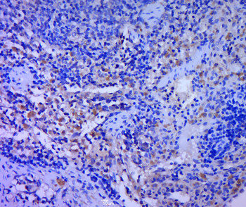 TLR6 Rabbit Polyclonal Antibody