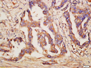 TLR6 Rabbit Polyclonal Antibody