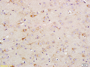 Phospho-TrkA (Tyr674 + Tyr675) + TrkB (Tyr706 + Tyr707) Rabbit Polyclonal Antibody