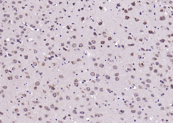 Phospho-TrkB (Tyr515) Rabbit Polyclonal Antibody