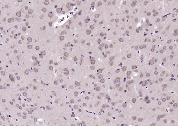 Phospho-TrkB (Tyr515) Rabbit Polyclonal Antibody